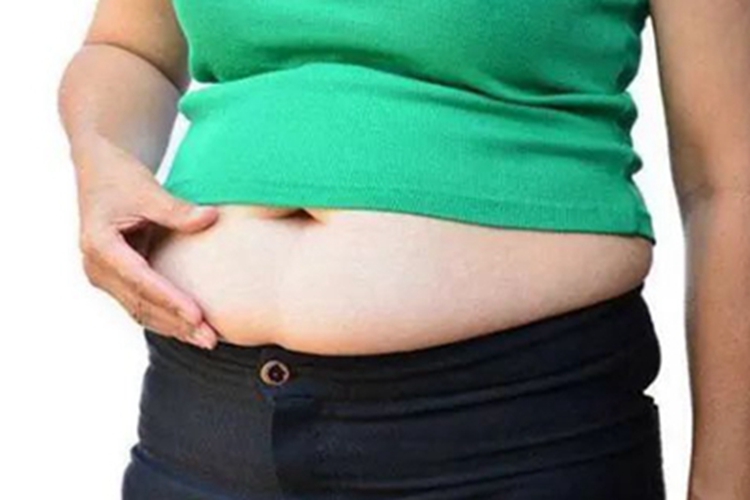 多囊卵巢综合征腹部症状图