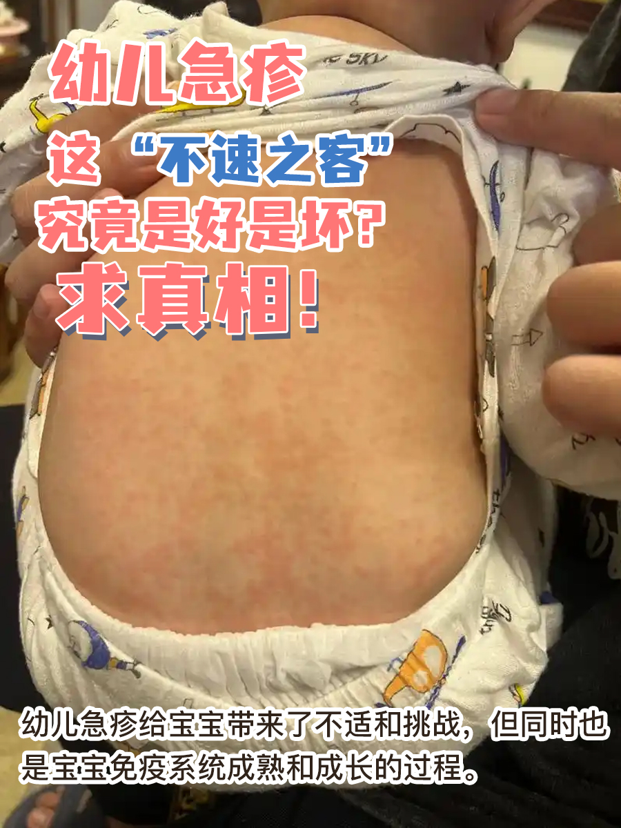幼儿急疹，这 “不速之客” 究竟是好是坏？