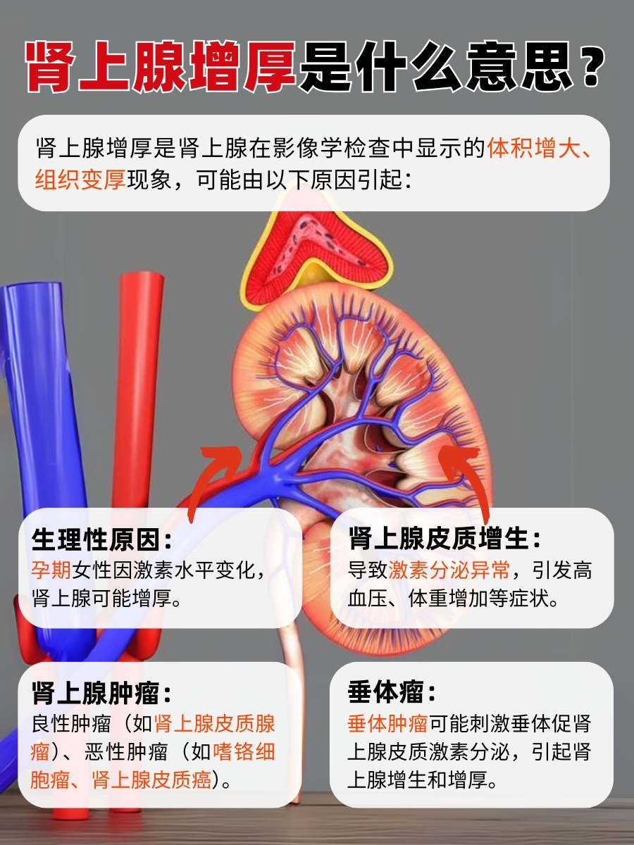 肾上腺增厚：身体在悄悄告诉你什么？