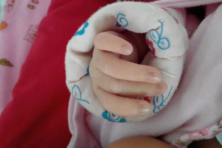 温度过低指甲根部发紫图 温度过低指甲根部发紫图