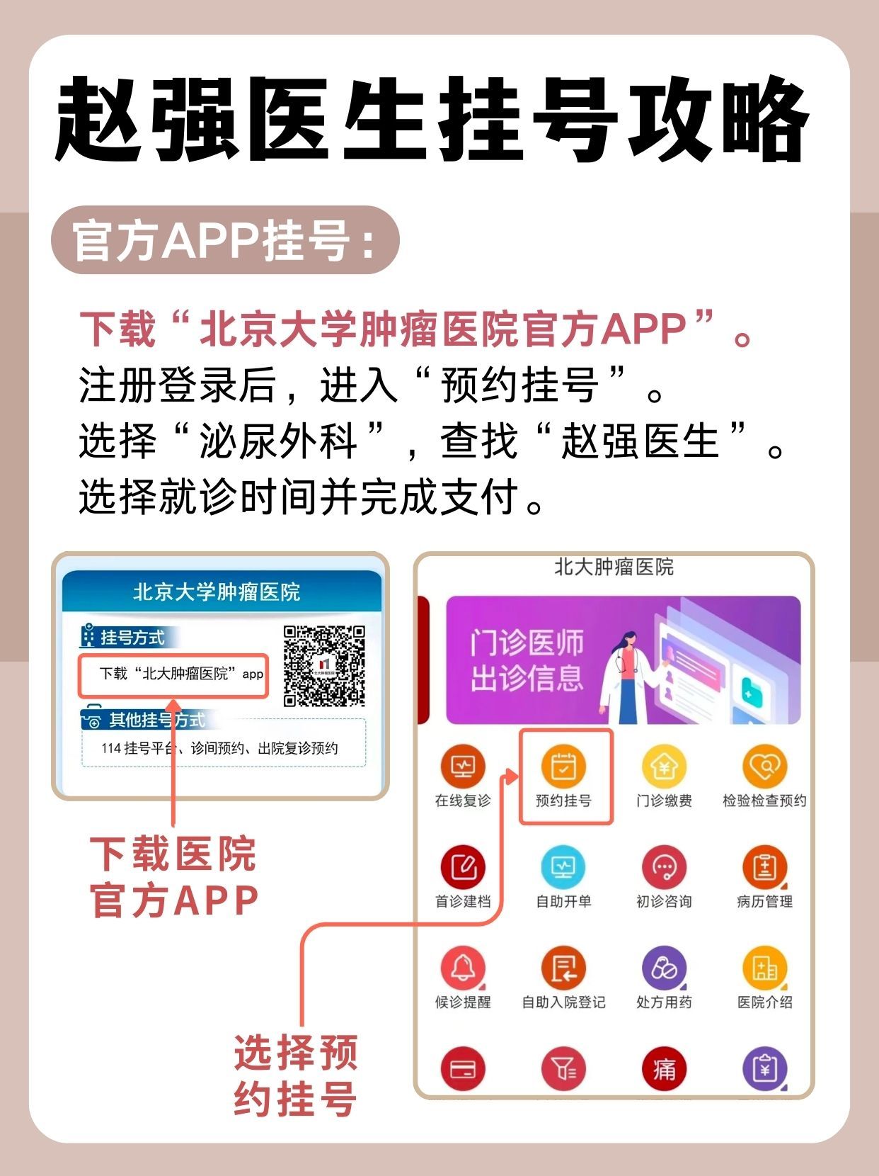 北京大学肿瘤医院赵强医生怎么样？怎么挂号？