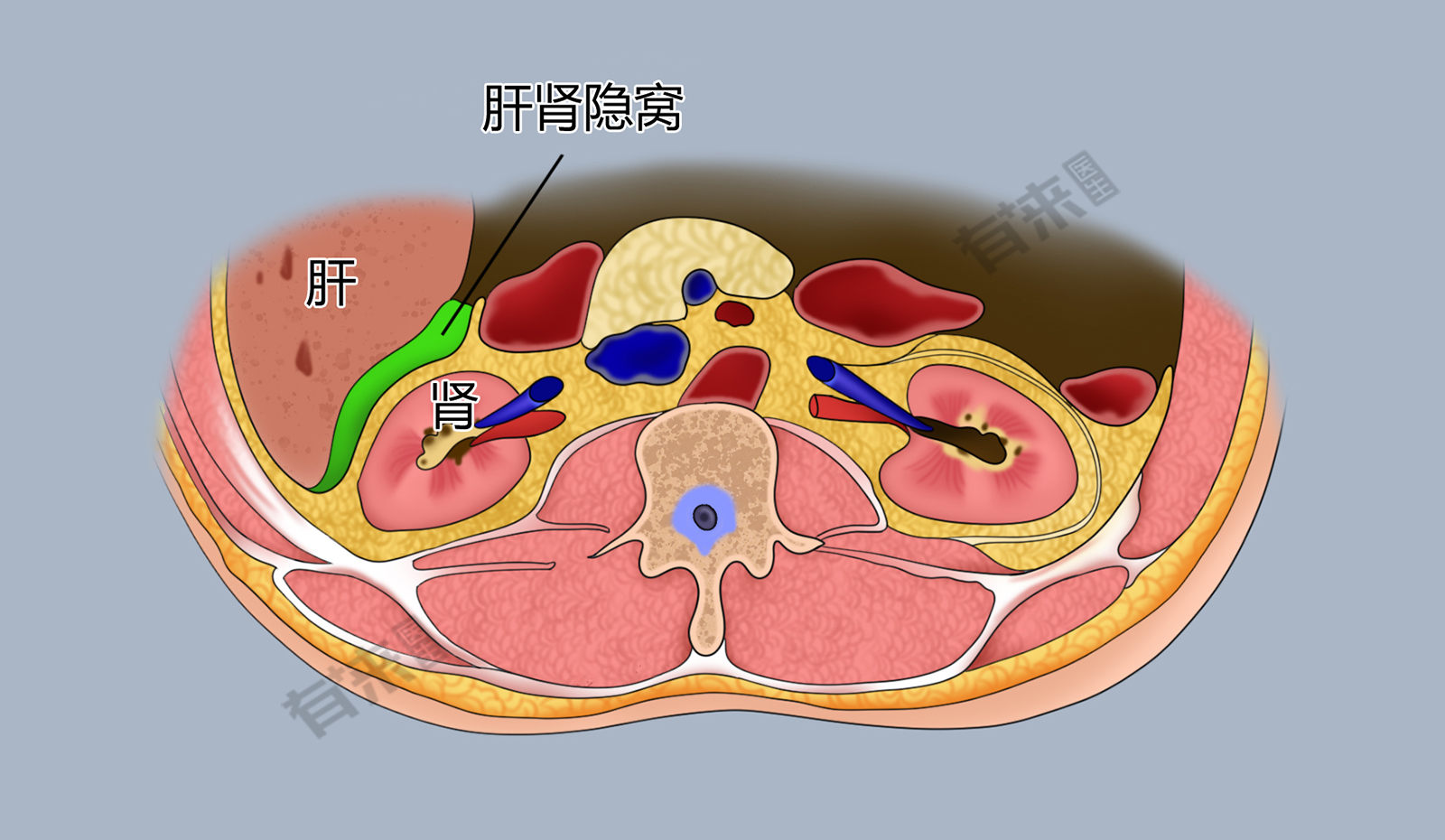 肝肾隐窝位于肝右叶下方深部与右肾之间,仰卧位时,是腹膜腔的最低部位