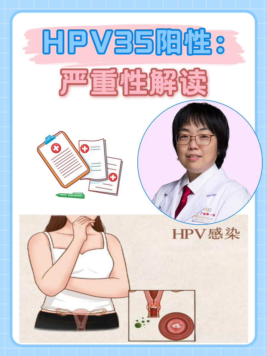 HPV35阳性：严重性解读