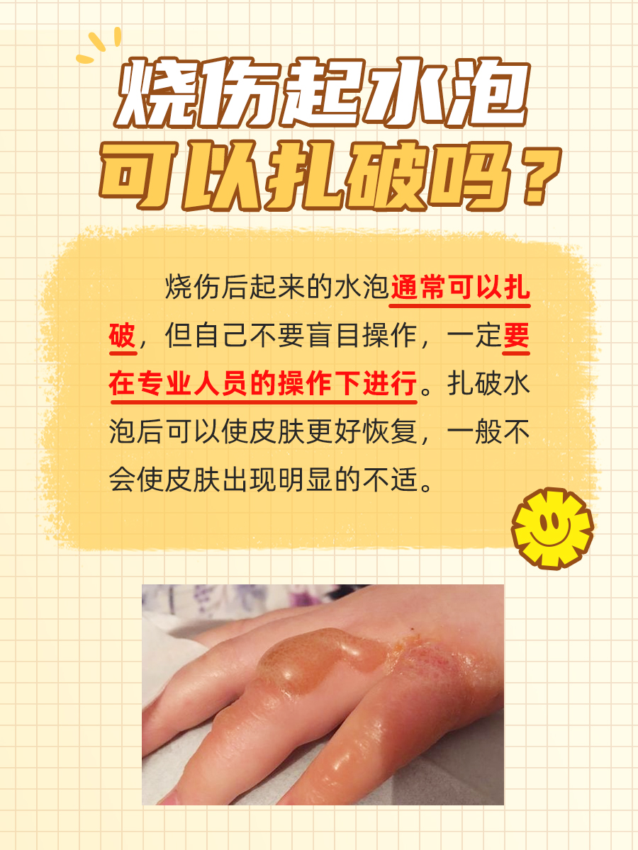 揭秘!烧伤水泡到底能不能扎破?