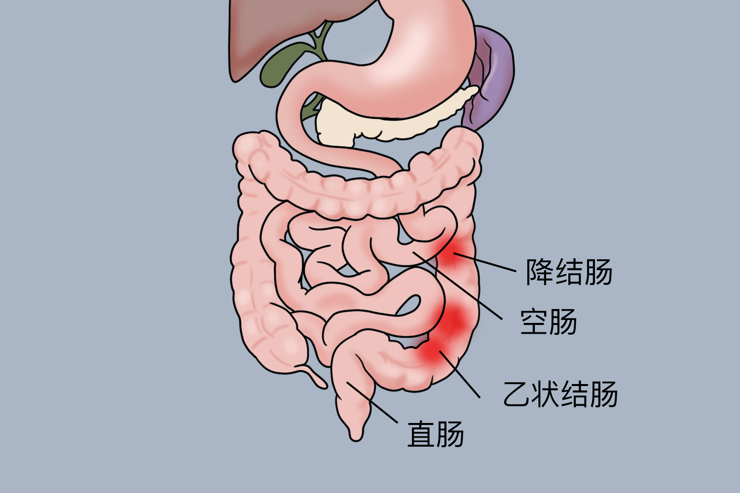 左下腹肠道疼痛部位图