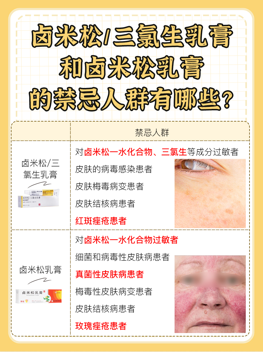 揭秘!卤米松/三氯生乳膏和卤米松乳膏一样吗?