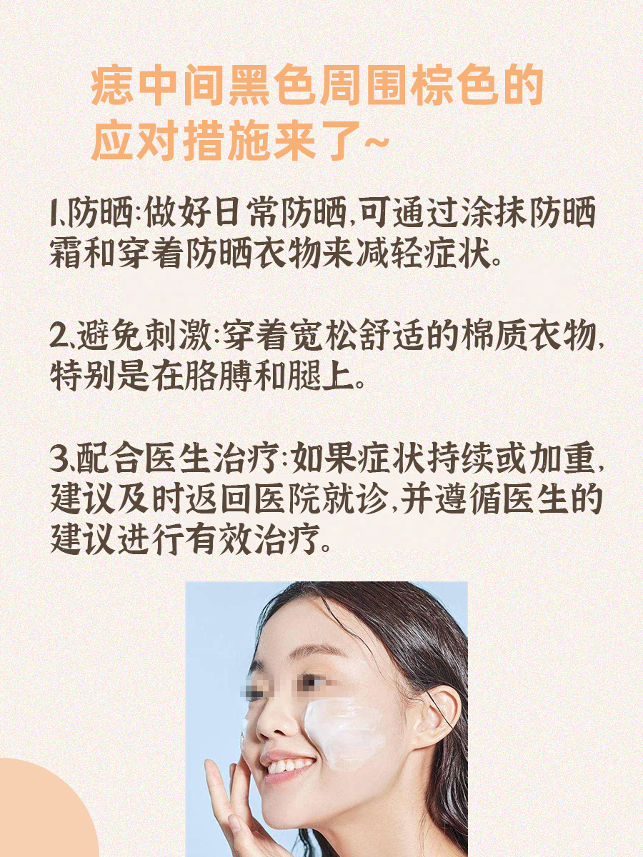 痣中间黑色周围棕色是咋了？一文帮你了解