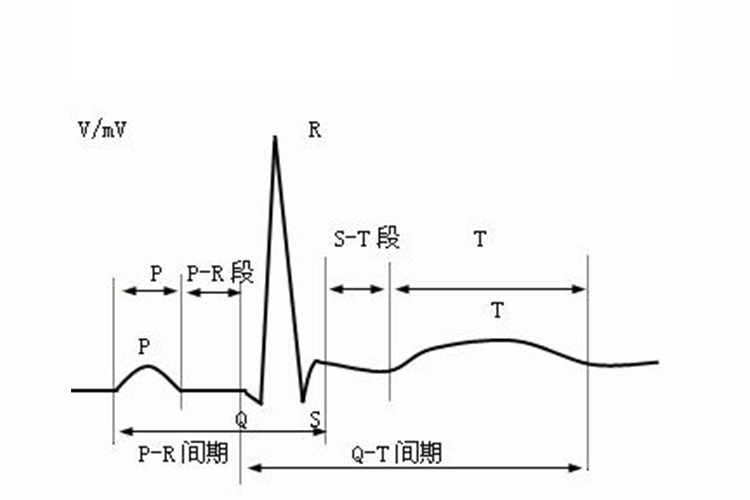 心电图