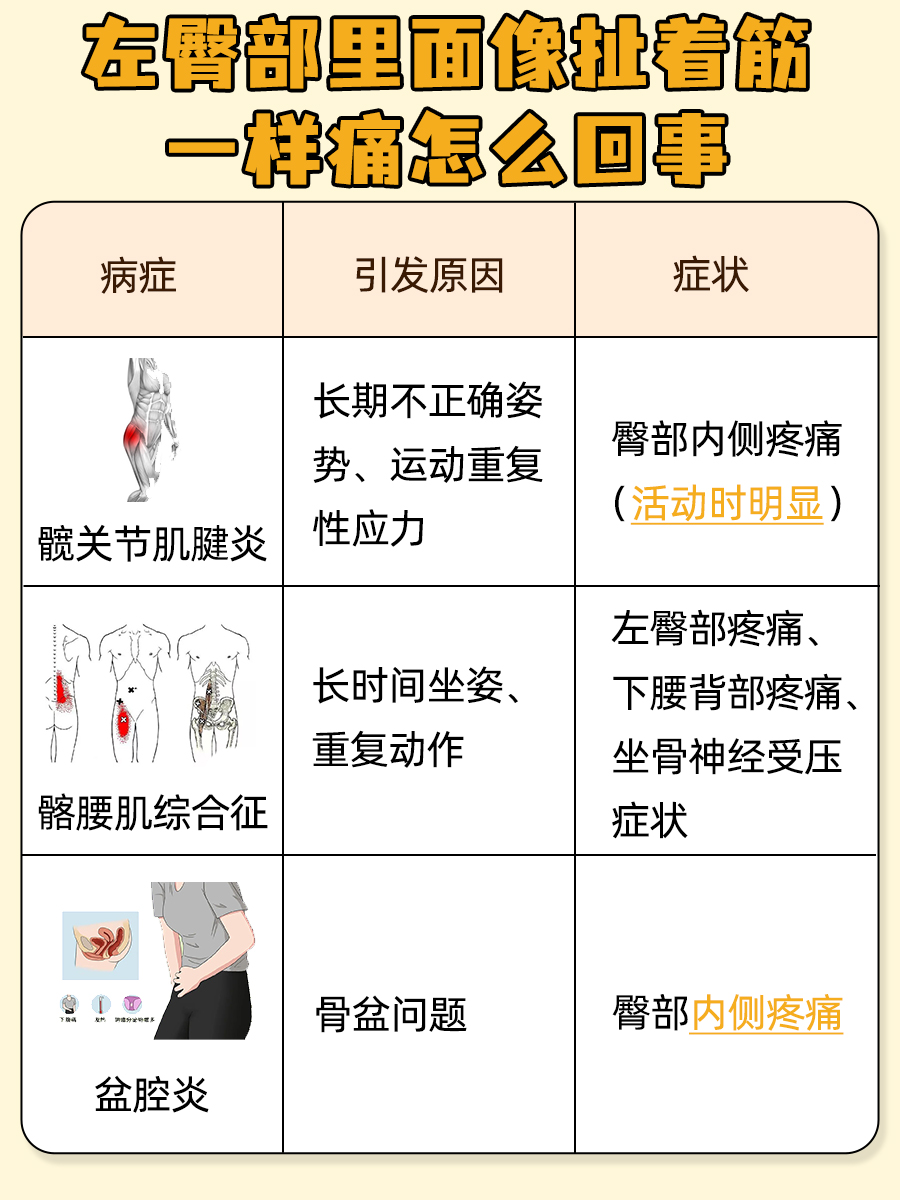 揭秘：左臀部里面像扯着筋一样痛是怎么回事