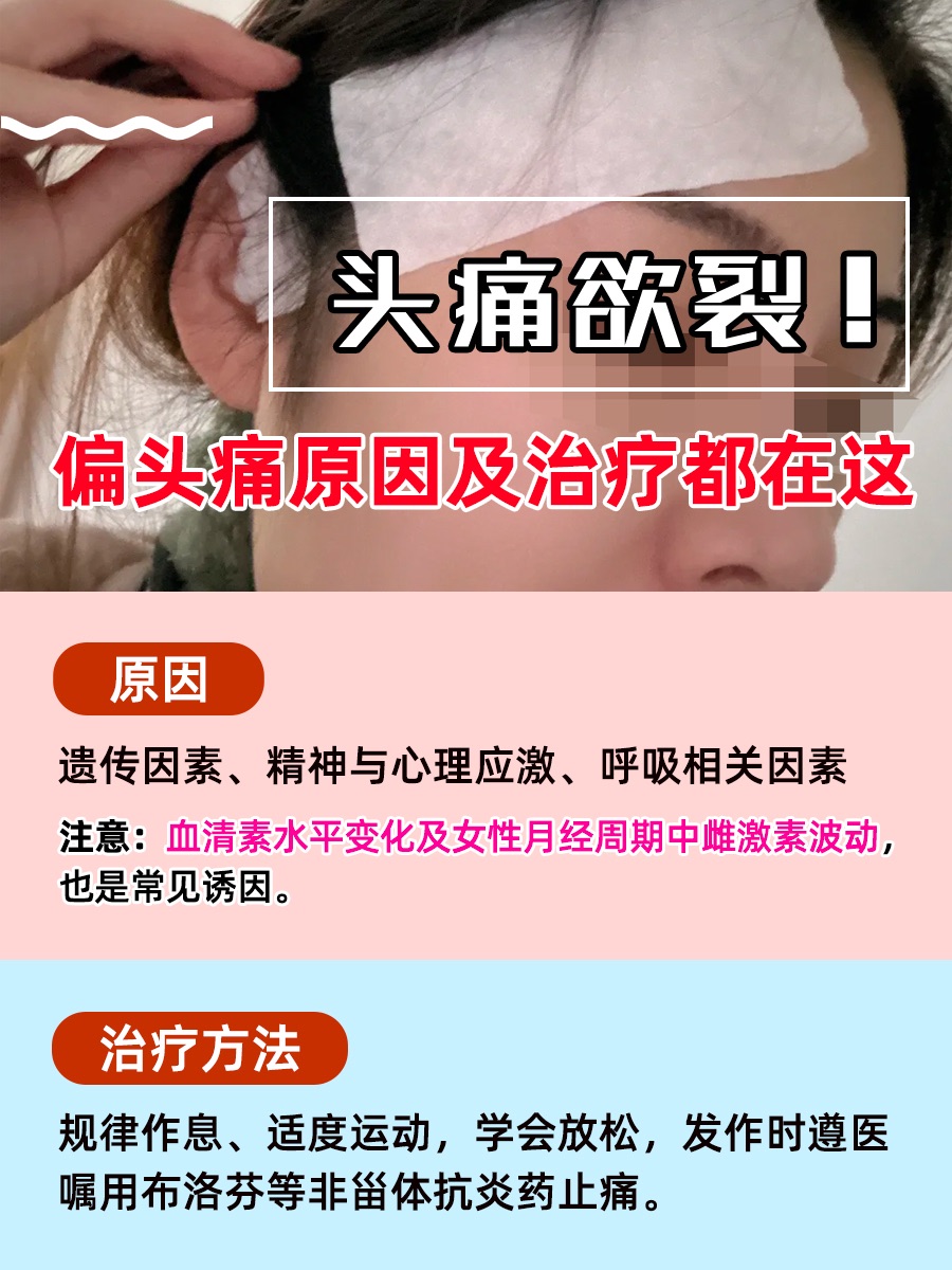 头痛欲裂！偏头痛原因及治疗都在这