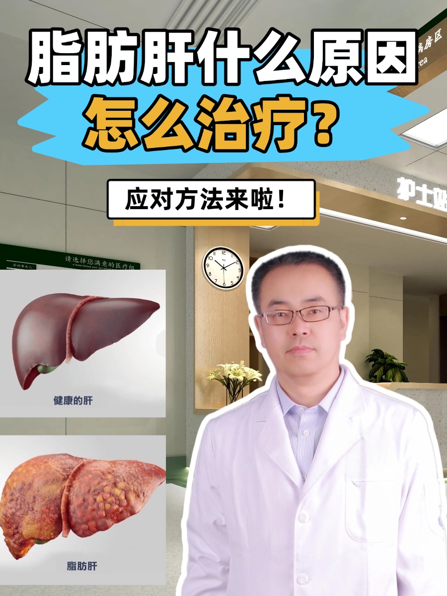 脂肪肝什么原因,怎么治疗?应对方法来啦!