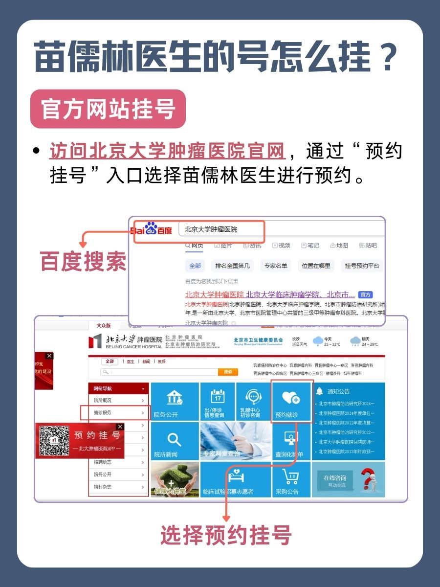 北京大学肿瘤医院苗儒林医生怎么样？怎么挂号？