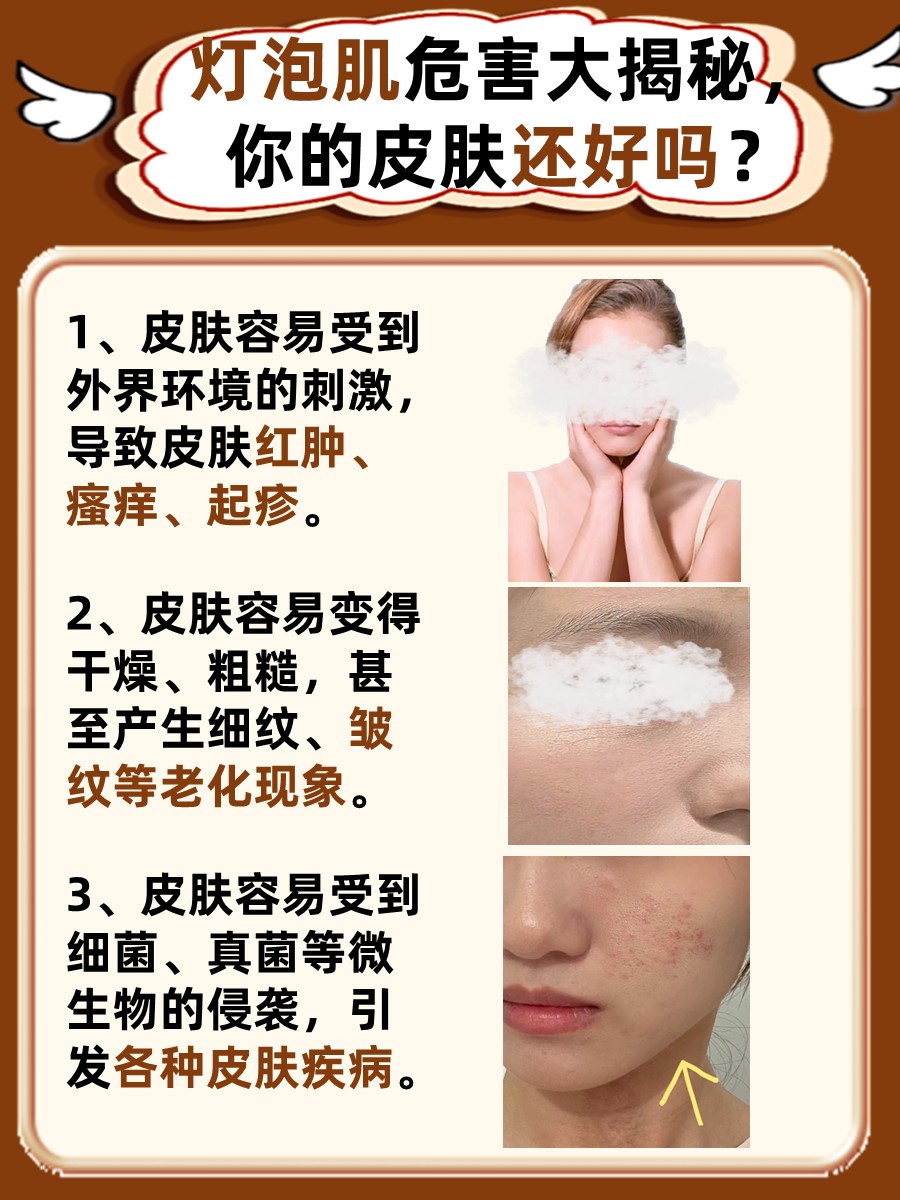灯泡肌危害大揭秘，你的皮肤还好吗？