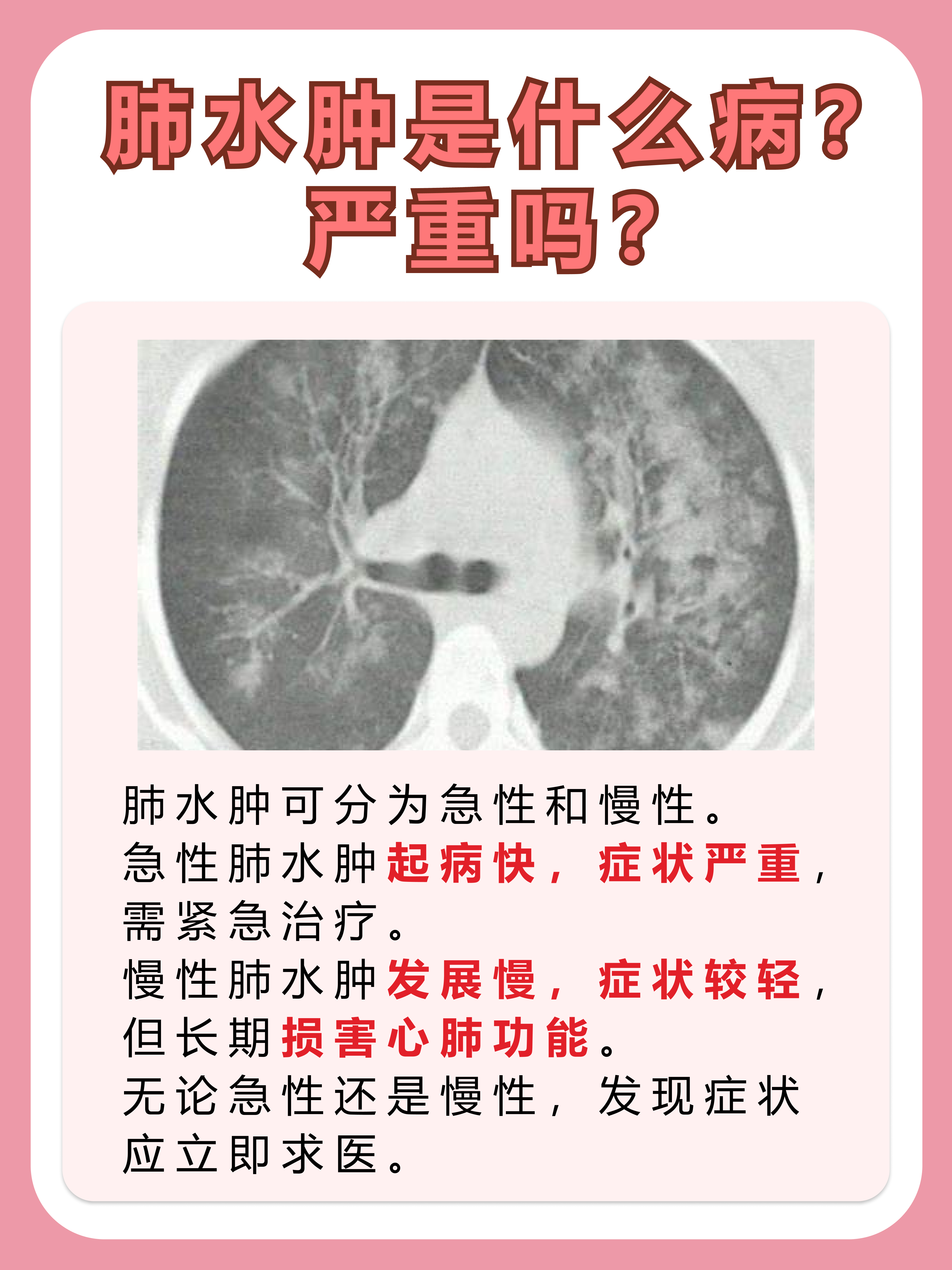 肺水肿的严重性：关注呼吸系统健康