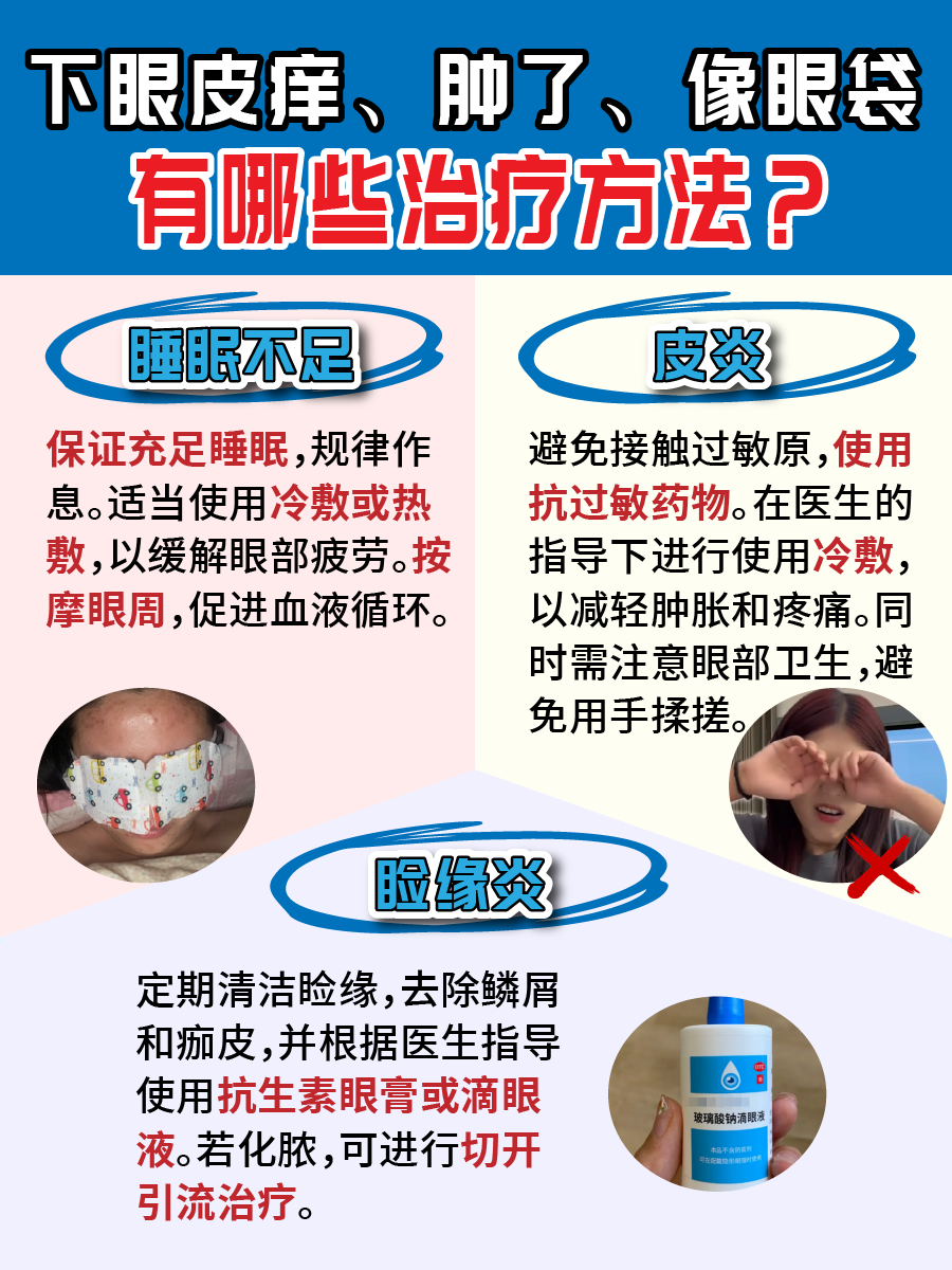 下眼皮痒、肿，像眼袋一样，这是怎么回事？