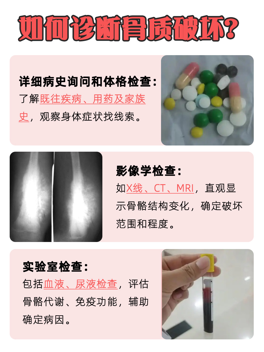 骨质破坏背后的故事：肿瘤？还是其他？