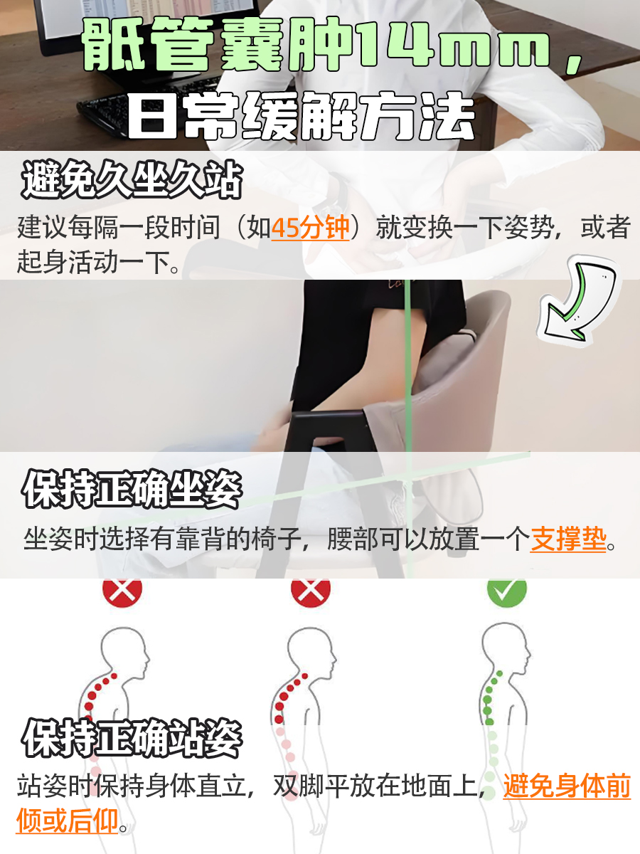 骶管囊肿14mm，情况咋样？严重不？