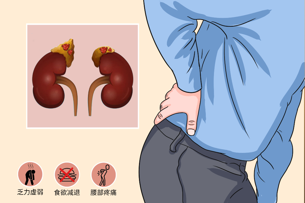 肾上长肿瘤严重吗怎么治