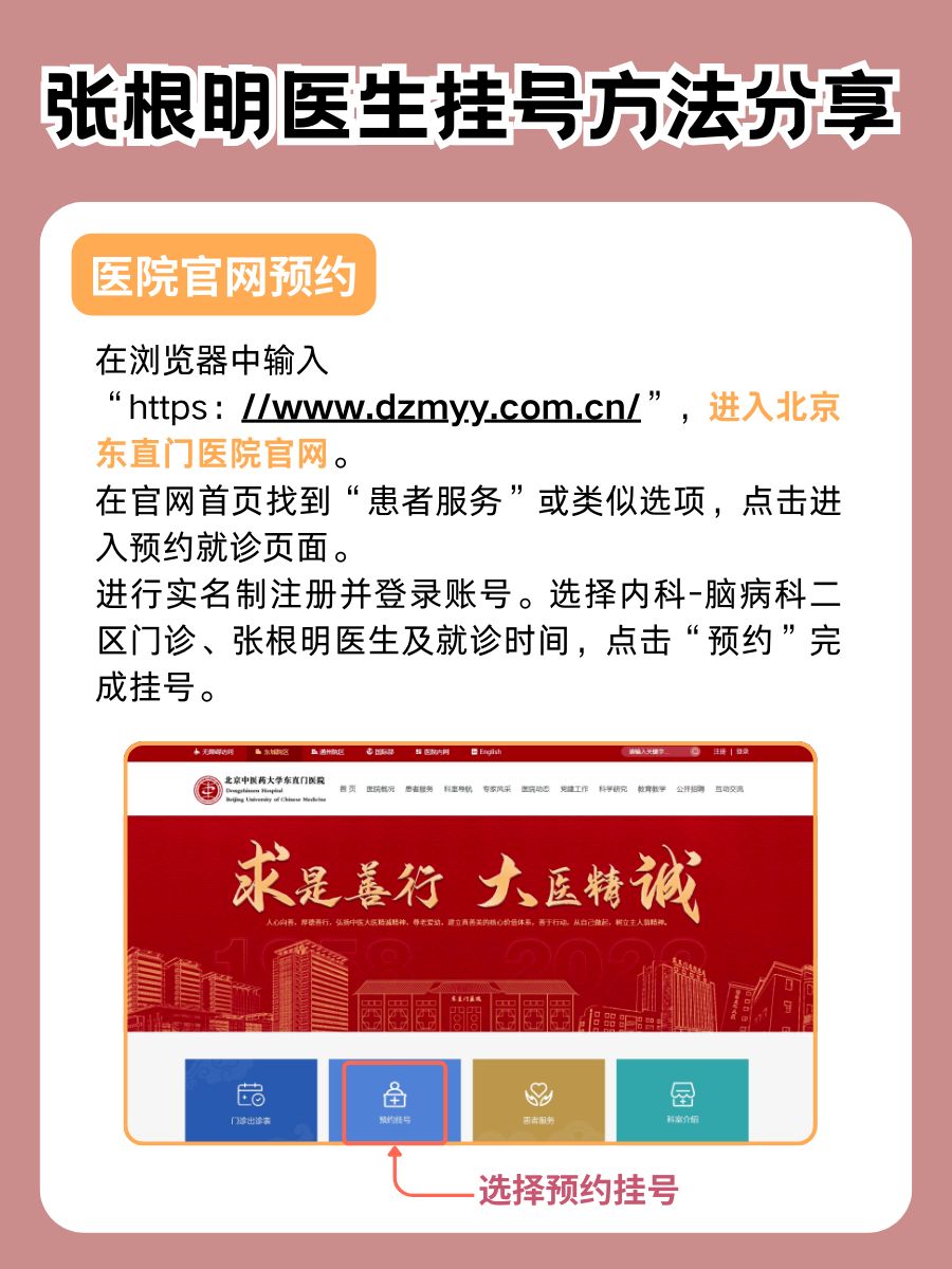 北京东直门医院张根明医生怎么样?怎么挂号?