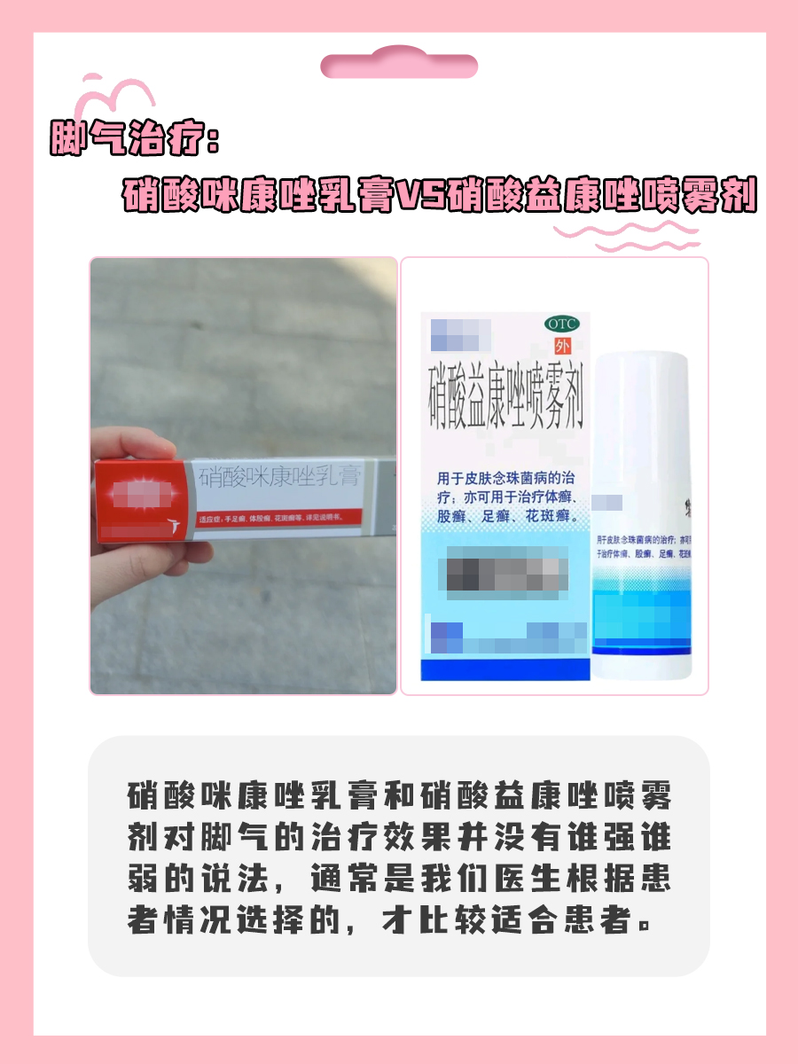 脚气治疗:硝酸咪康唑乳膏VS硝酸益康唑喷雾剂