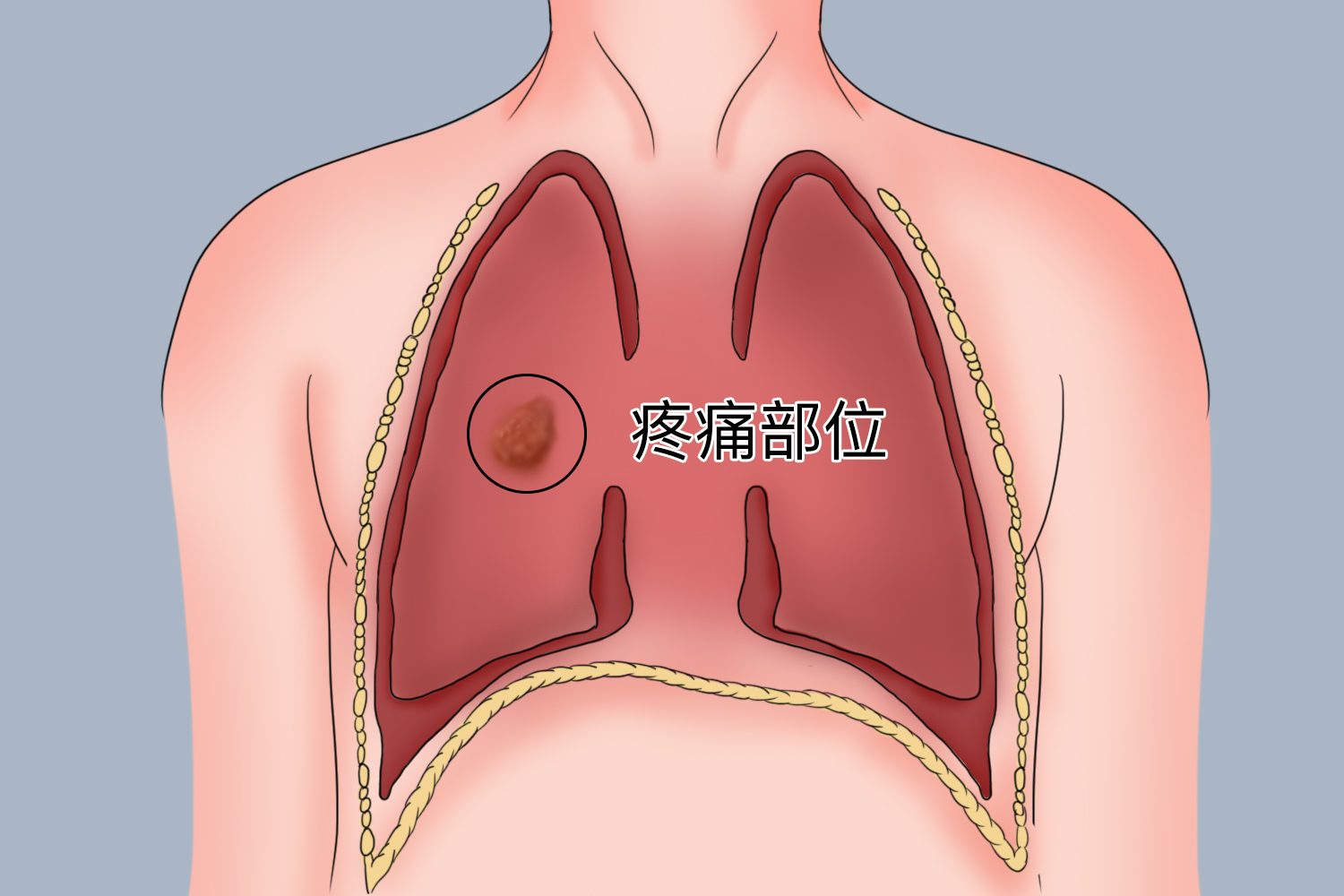 肺不好胸痛位置图 肺不好胸痛位置图