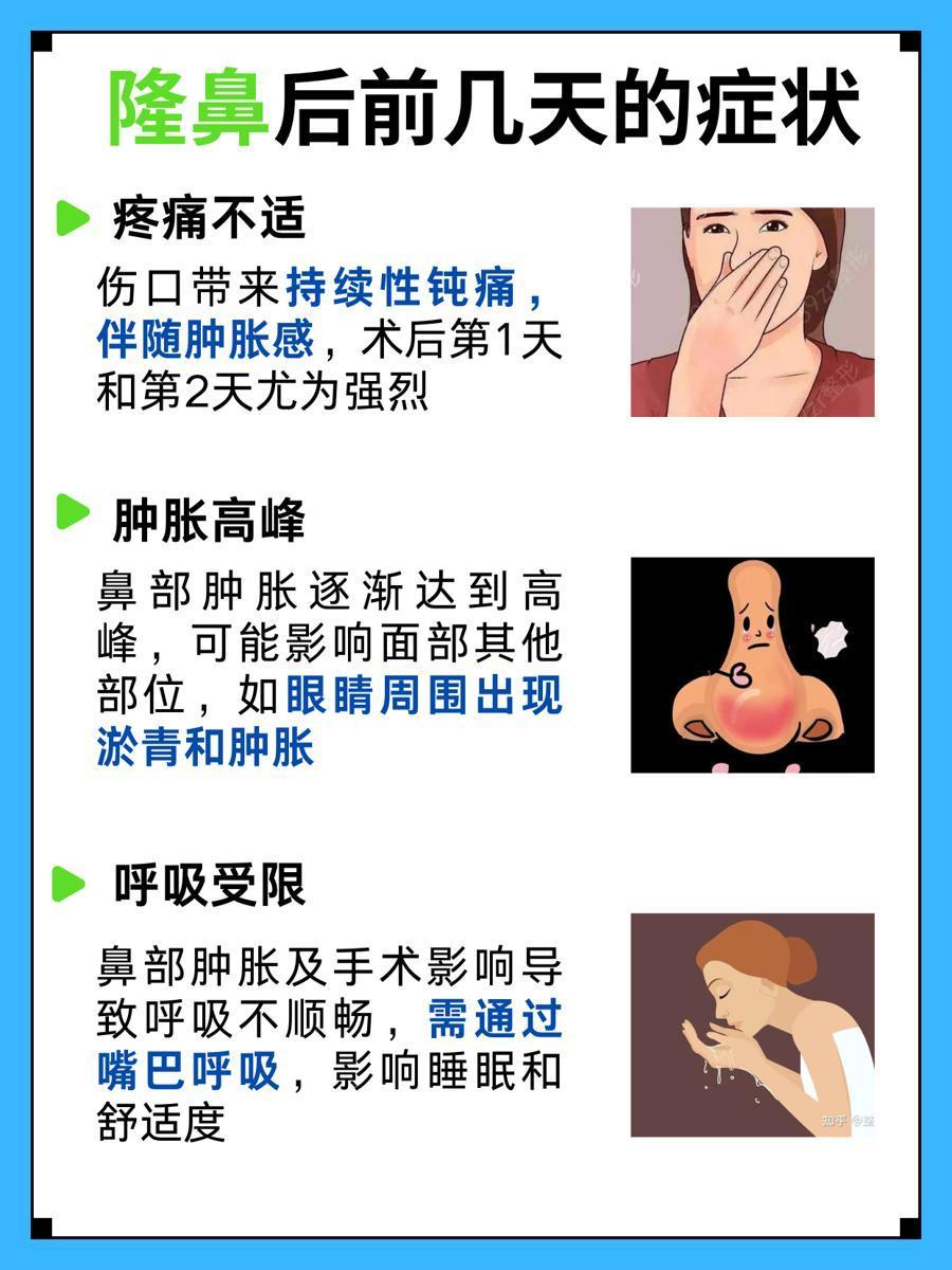 隆鼻后最难熬的几天有啥症状,你知道吗?