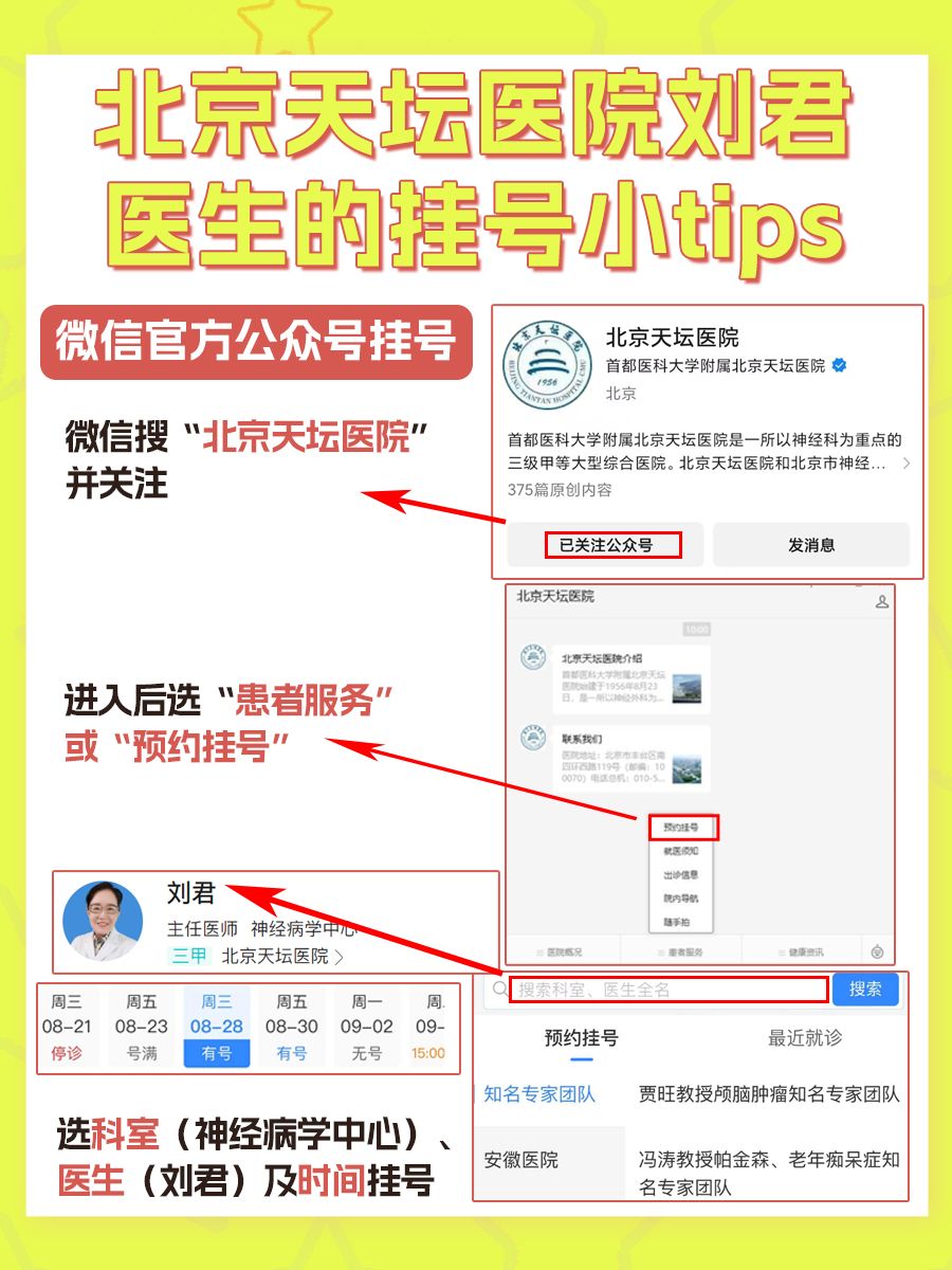 北京天坛医院刘君医生怎么样?怎么挂号?