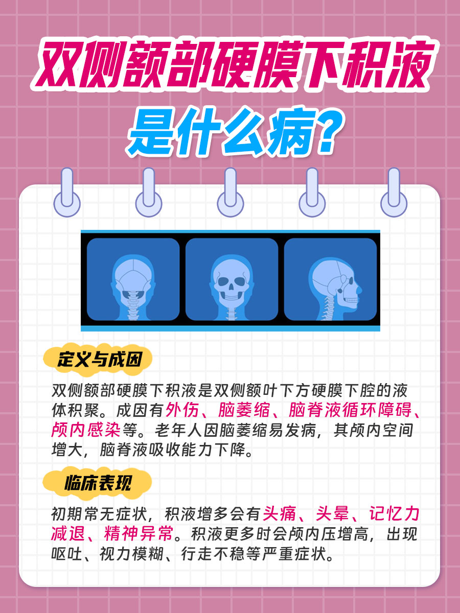 揭秘：双侧额部硬膜下积液是什么病