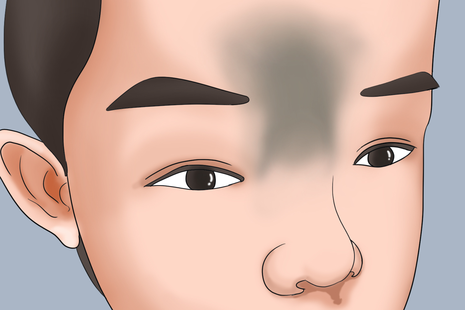 宝宝外伤眉心发青图