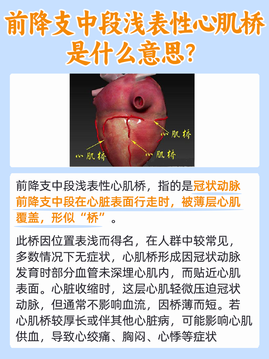 前降支中段浅表性心肌桥是什么意思，你知道吗？