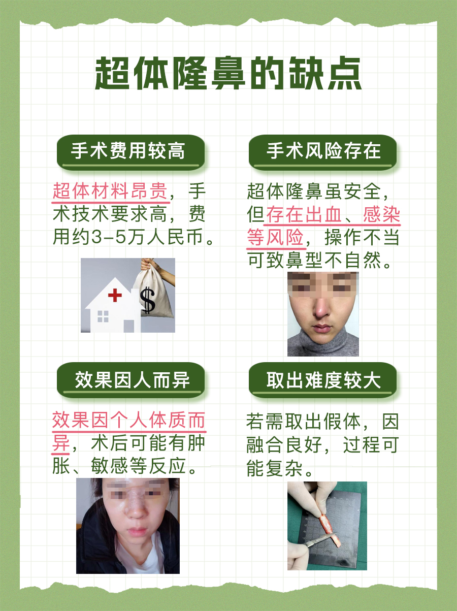 深度剖析超体隆鼻的优点和缺点