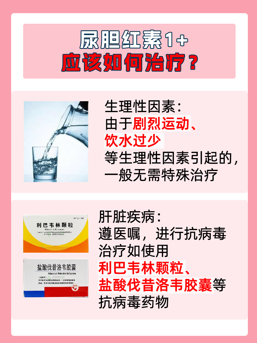 体检报告:尿胆红素1+,严重吗?一文读懂