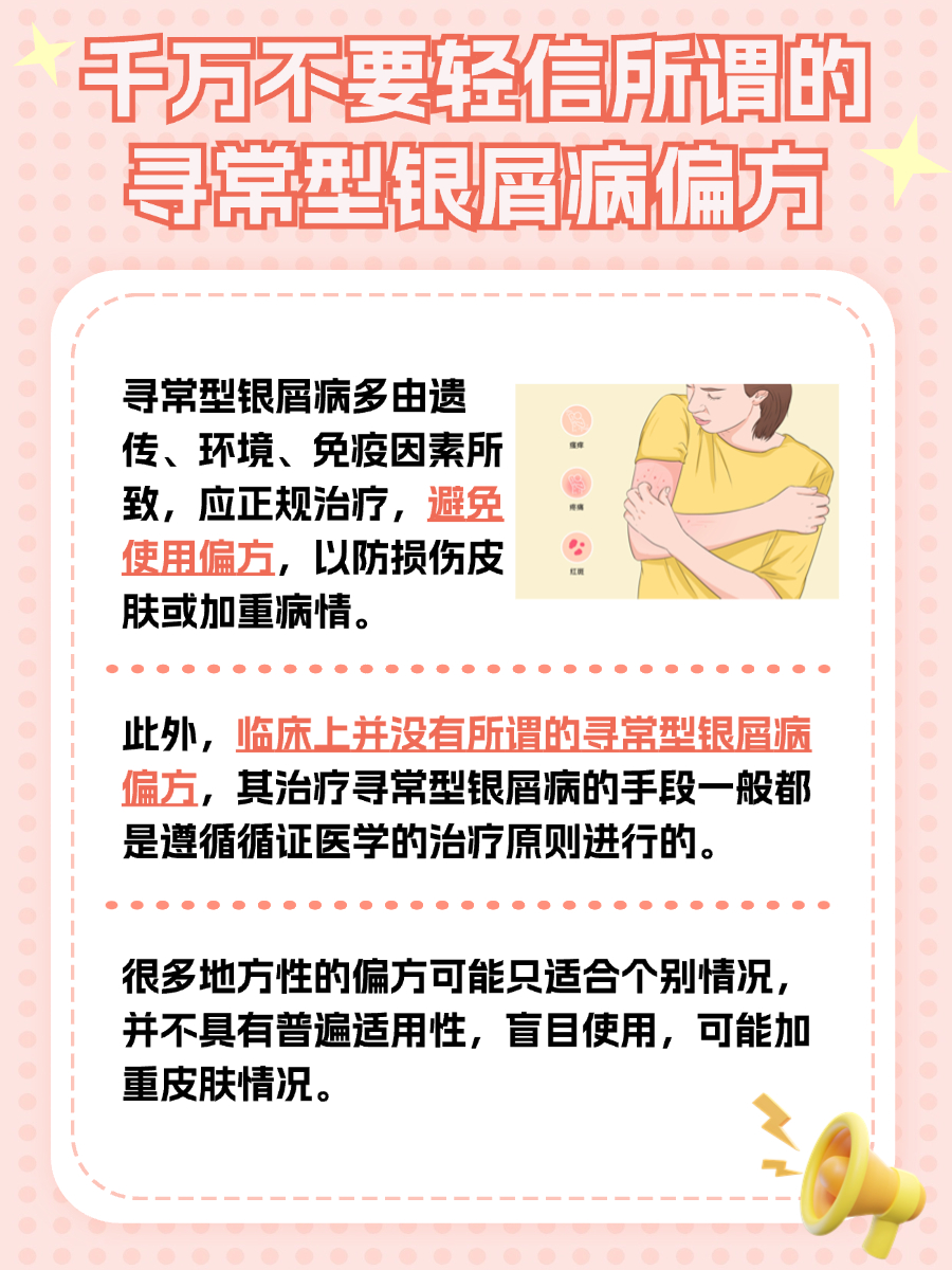 辟谣：并没有专治牛皮癣的偏方