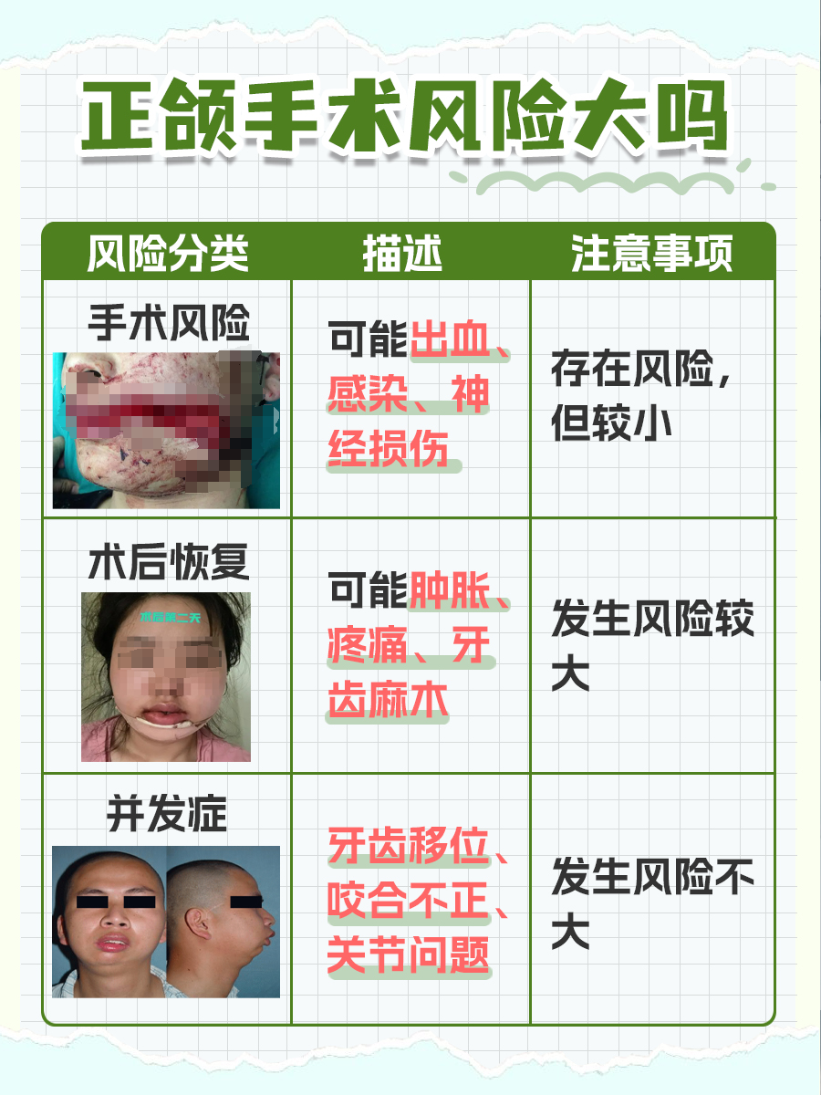 探究：正颌手术风险知多少？