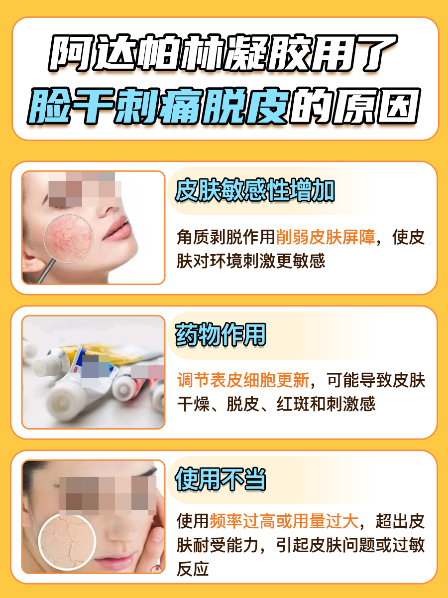 阿达帕林凝胶副作用:脸干刺痛脱皮怎么办?