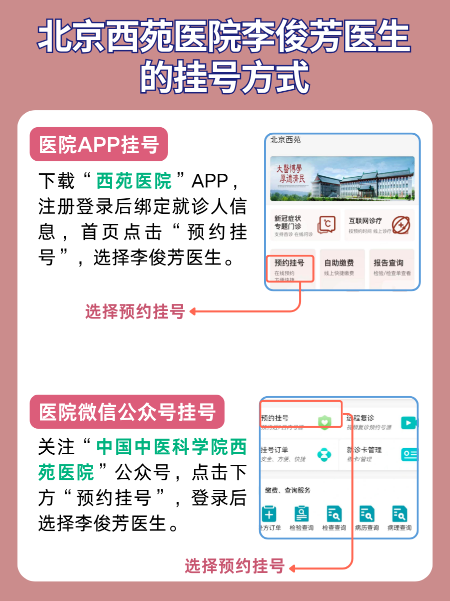 北京西苑医院李俊芳医生怎么样？怎么挂号？