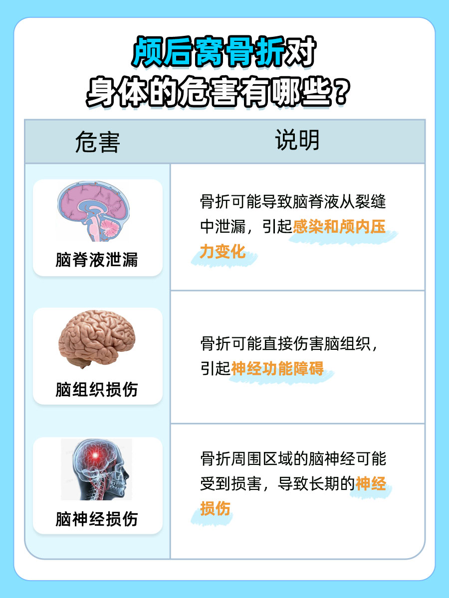 颅底骨折:识别颅后窝骨折的典型症状