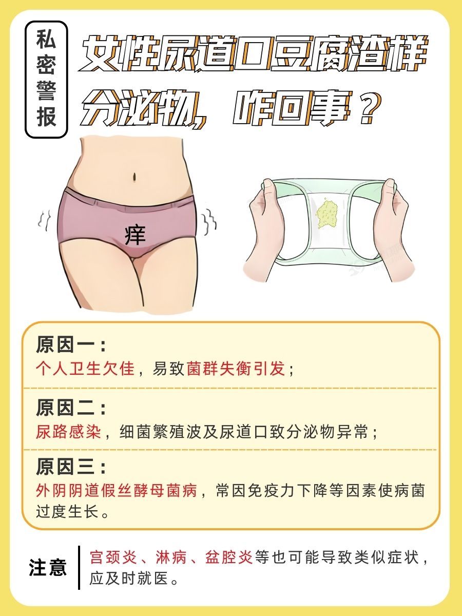 私密警报!女性尿道口豆腐渣样分泌物,咋回事?