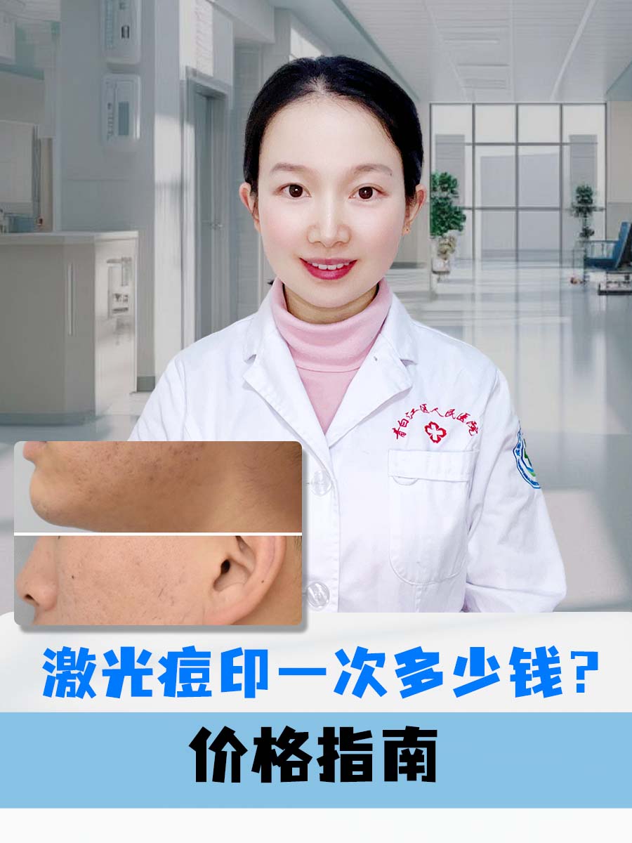 激光痘印一次多少钱？价格指南