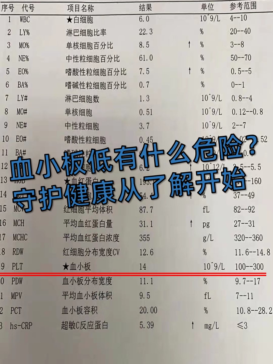 血小板低有什么危险？守护健康从了解开始