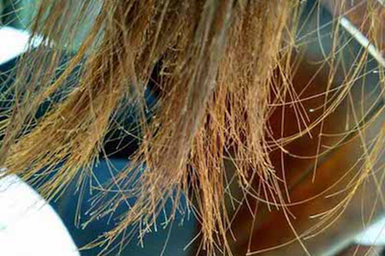 念珠状发毛发干燥图