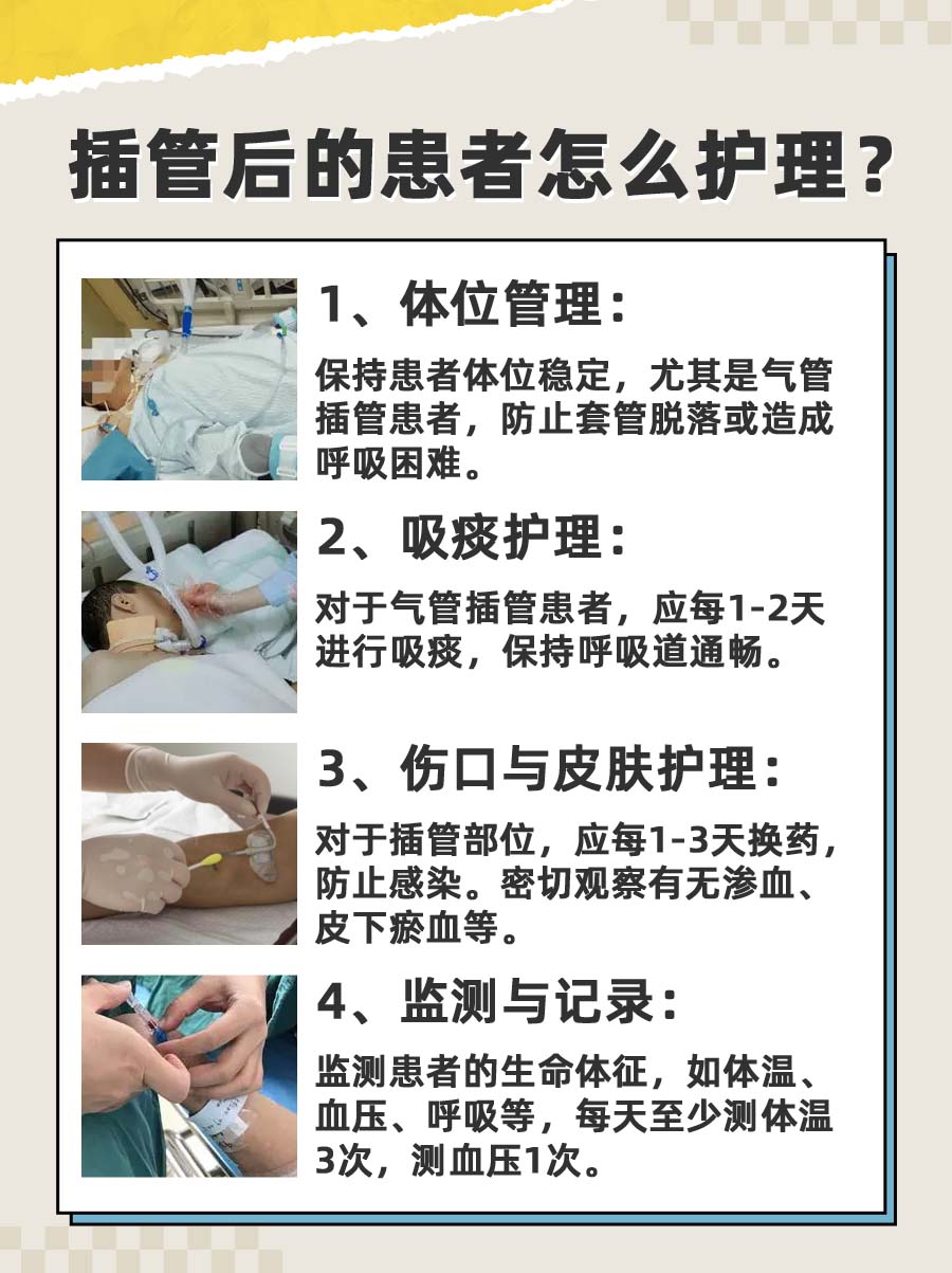 插管是什么意思？医生为你解答