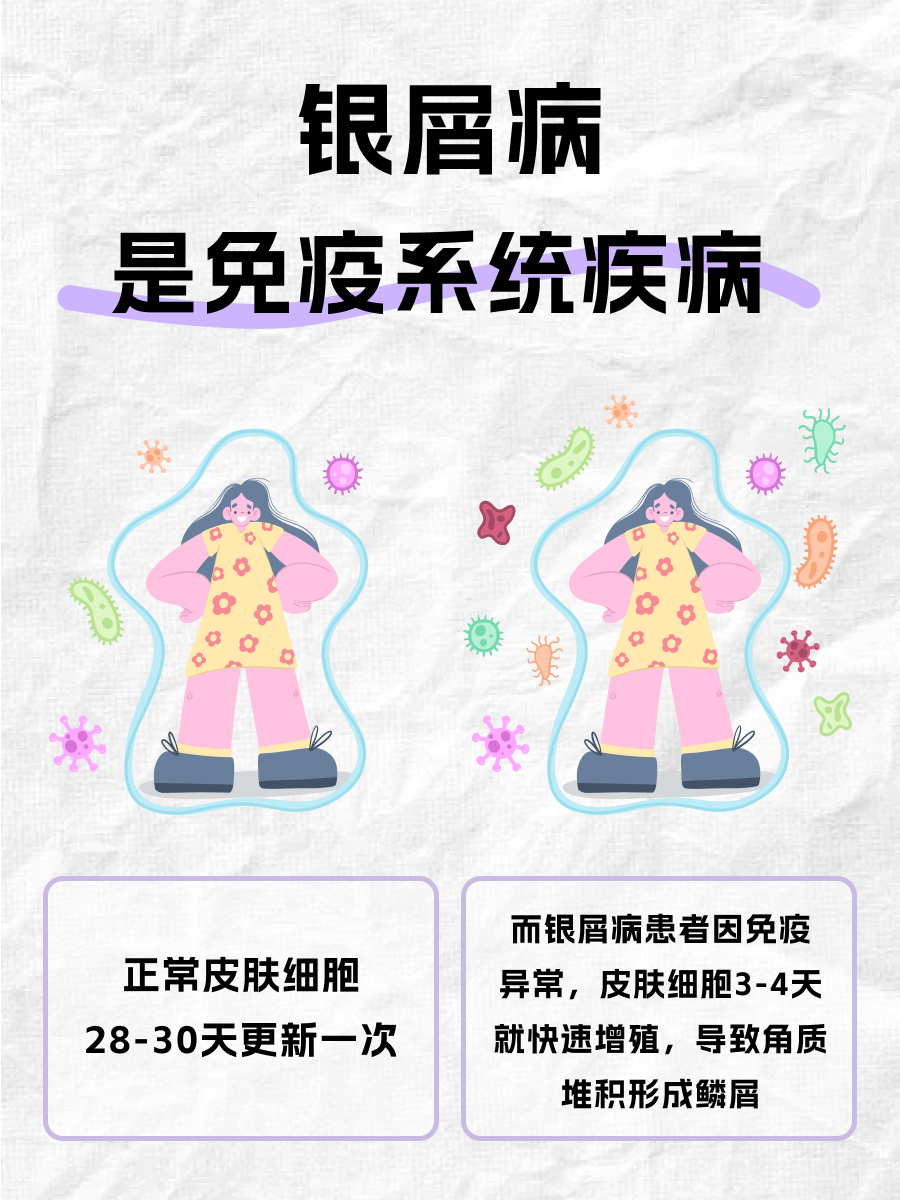 银屑病会不会传染给别人？皮肤科医生来辟谣