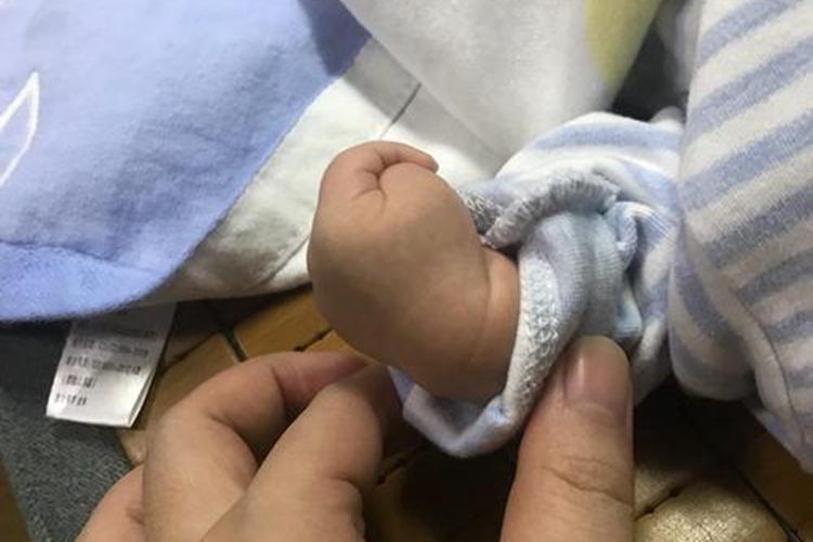 正常新生儿手腕内弯图