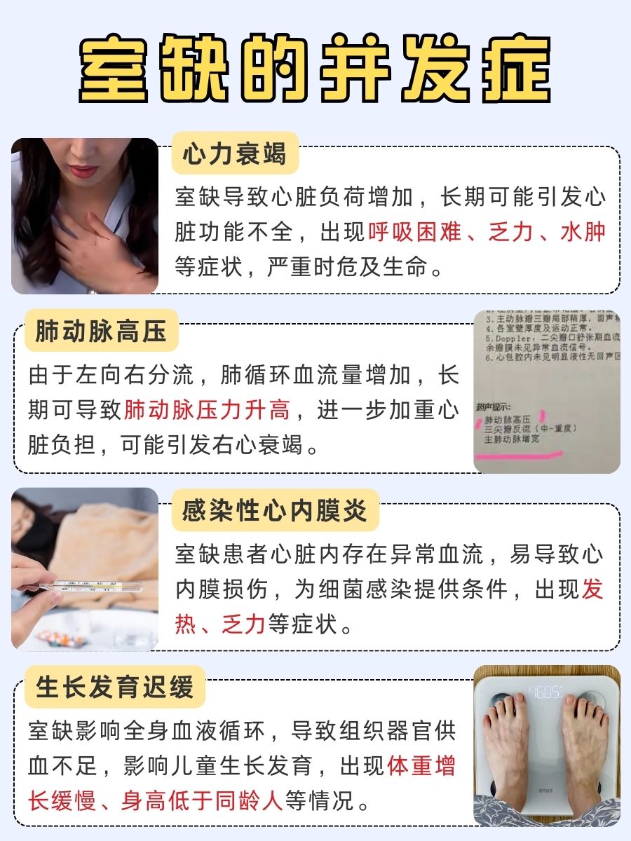 室缺会随娃长大而扩大？医生给你说道说道！