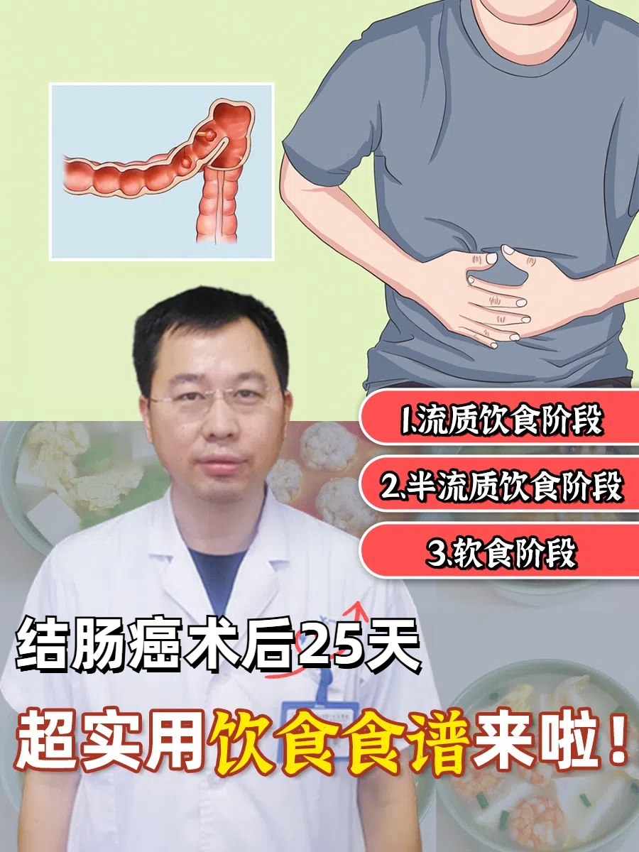结肠癌术后25天，超实用饮食食谱来啦！