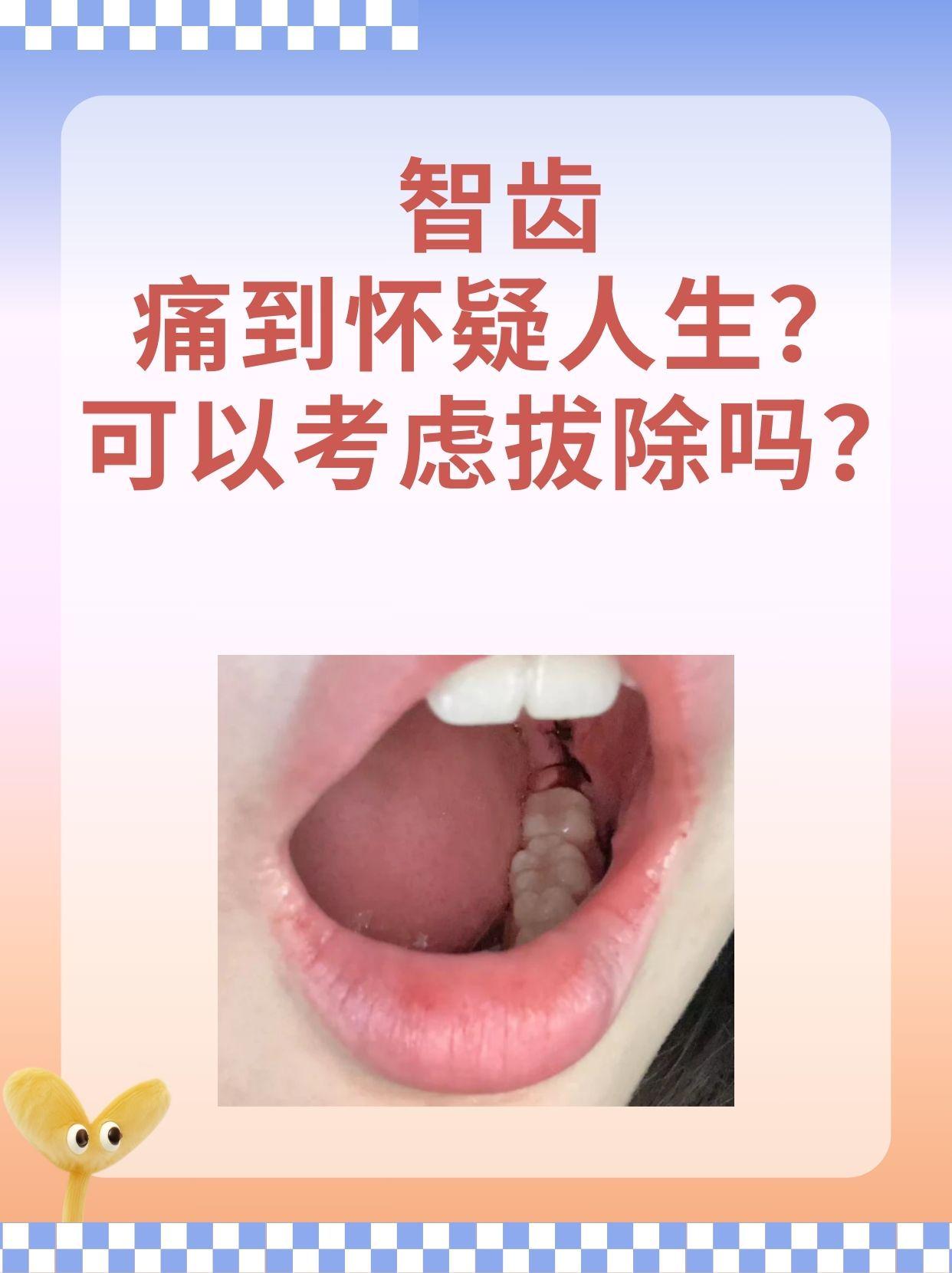 智齿痛到怀疑人生？可以考虑拔除吗？