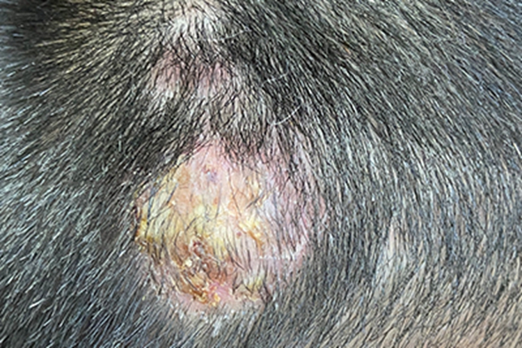 黄癣头皮丘疹图