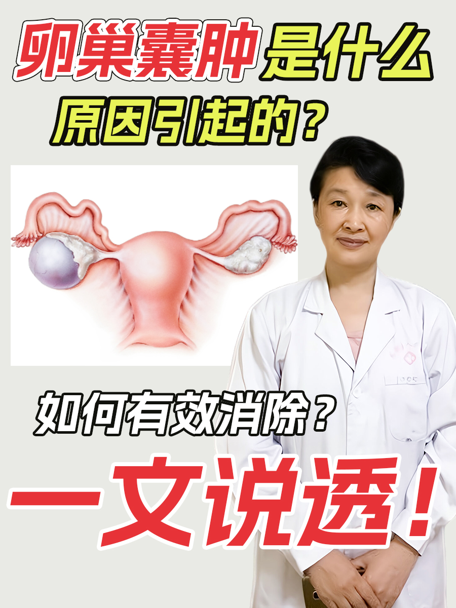 卵巢囊肿是什么原因引起的？如何有效消除？一文说透！
