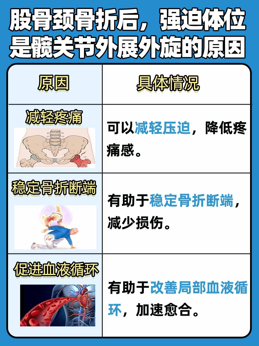揭秘股骨颈骨折后，为啥伤肢要“外展外旋”？